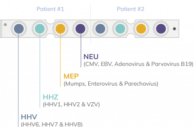 MP01-Meningitis viral panel